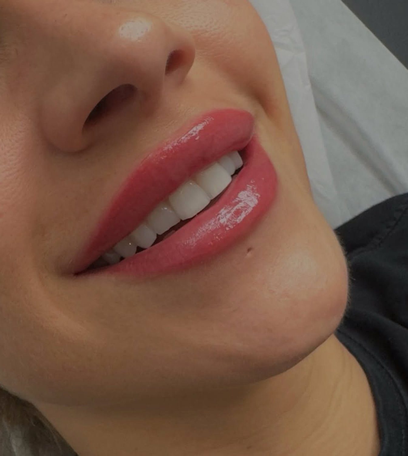 Soft healed lip blush result